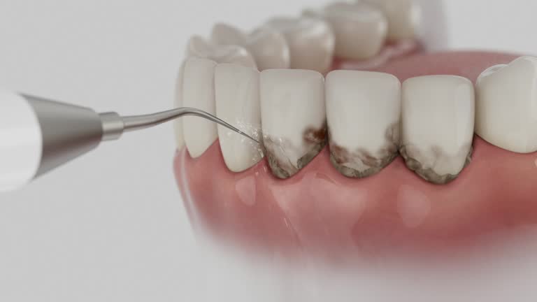 Reliable Dental contractor in Evansville, WI by Smile Center Dentistry